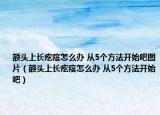 额头上长疙瘩怎么办 从5个方法开始吧图片（额头上长疙瘩怎么办 从5个方法开始吧）