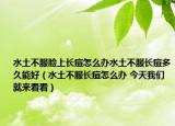 水土不服脸上长痘怎么办水土不服长痘多久能好（水土不服长痘怎么办 今天我们就来看看）