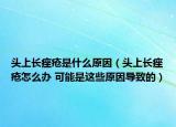 头上长痤疮是什么原因（头上长痤疮怎么办 可能是这些原因导致的）