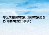 怎么改变眼珠发黄（眼珠发黄怎么办 需要做好以下事项）