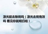 激光能去除斑吗（激光去斑有效吗 看完你就明白啦）