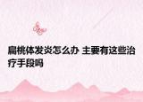 扁桃体发炎怎么办 主要有这些治疗手段吗
