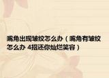 嘴角出现皱纹怎么办（嘴角有皱纹怎么办 4招还你灿烂笑容）