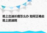 脸上出油长痘怎么办 如何正确去脸上的油斑