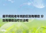扁平疣和老年斑的区别有哪些 分别有哪些治疗方法呢