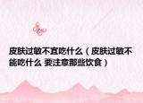 皮肤过敏不宜吃什么（皮肤过敏不能吃什么 要注意那些饮食）