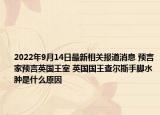 2022年9月14日最新相关报道消息 预言家预言英国王室 英国国王查尔斯手脚水肿是什么原因