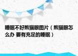 睡眠不好熊猫眼图片（熊猫眼怎么办 要有充足的睡眠）