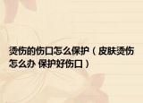 烫伤的伤口怎么保护（皮肤烫伤怎么办 保护好伤口）