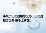 手摸了山药过敏怎么办（山药过敏怎么办 在手上抹醋）