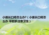 小孩长口疮怎么办?（小孩长口疮怎么办 平时多注意卫生）
