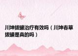 川坤拔罐治疗有效吗（川坤春草拔罐是真的吗）