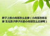 脖子上的小肉球怎么去掉（小肉球怎样去掉 生完孩子脖子长的小肉球怎么去掉呢）