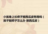 小孩身上长痱子擦西瓜皮有用吗（孩子起痱子怎么办 擦西瓜皮）