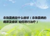 念珠菌病是什么症状（念珠菌病的病原及症状 如何进行治疗）