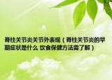 脊柱关节炎关节外表现（脊柱关节炎的早期症状是什么 饮食保健方法需了解）