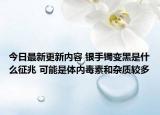 今日最新更新内容 银手镯变黑是什么征兆 可能是体内毒素和杂质较多