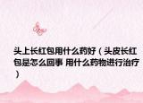 头上长红包用什么药好（头皮长红包是怎么回事 用什么药物进行治疗）