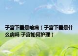 子宫下垂是啥病（子宫下垂是什么病吗 子宫如何护理）
