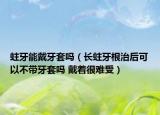 蛀牙能戴牙套吗（长蛀牙根治后可以不带牙套吗 戴着很难受）