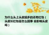 为什么头上头皮挺多的还有红包（头皮长红包是怎么回事 会影响头皮吗）