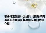 银手镯变黑是什么征兆 可能是体内毒素和杂质较多具体情况详细内容介绍