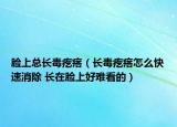 脸上总长毒疙瘩（长毒疙瘩怎么快速消除 长在脸上好难看的）