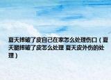 夏天摔破了皮自己在家怎么处理伤口（夏天腿摔破了皮怎么处理 夏天皮外伤的处理）