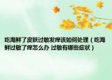 吃海鲜了皮肤过敏发痒该如何处理（吃海鲜过敏了痒怎么办 过敏有哪些症状）