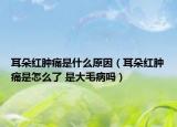 耳朵红肿痛是什么原因（耳朵红肿痛是怎么了 是大毛病吗）