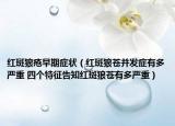 红斑狼疮早期症状（红斑狼苍并发症有多严重 四个特征告知红斑狼苍有多严重）