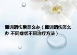 军训晒伤后怎么办（军训晒伤怎么办 不同症状不同治疗方法）