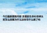 今日最新更新内容 亲爱的生命杜帝掉头发怎么回事为什么这样生什么病了吗