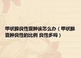 甲状腺良性囊肿该怎么办（甲状腺囊肿良性的比例 良性多吗）