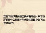 双侧下肢浮肿的原因具体有哪些（双下肢浮肿是什么原因 5种病理性原因导致下肢容易浮肿）
