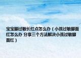 宝宝脚过敏长红点怎么办（小孩过敏脚面红怎么办 分享三个方法解决小孩过敏脚面红）