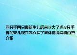 四只手四只脚新生儿后来长大了吗 8只手脚的婴儿现在怎么样了具体情况详细内容介绍