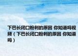 下巴长闭口粉刺的原因 你知道吗视频（下巴长闭口粉刺的原因 你知道吗）