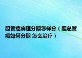 胆管癌病理分期怎样分（胆总管癌如何分期 怎么治疗）