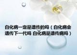 白化病一定是遗传的吗（白化病会遗传下一代吗 白化病是遗传病吗）