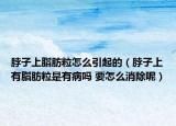 脖子上脂肪粒怎么引起的（脖子上有脂肪粒是有病吗 要怎么消除呢）