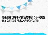 黑色素痣切除手术前注意事项（手术黑色素多久可以消 手术之后要怎么护理）