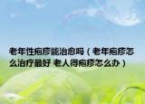 老年性疱疹能治愈吗（老年疱疹怎么治疗最好 老人得疱疹怎么办）
