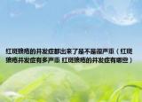 红斑狼疮的并发症都出来了是不是很严重（红斑狼疮并发症有多严重 红斑狼疮的并发症有哪些）