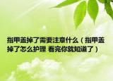 指甲盖掉了需要注意什么（指甲盖掉了怎么护理 看完你就知道了）
