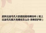 皮肤出油毛孔大的原因是有螨虫吗（脸上出油毛孔粗大有螨虫怎么办 来教你护肤）
