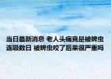 当日最新消息 老人头痛竟是被蜱虫连吸数日 被蜱虫咬了后果很严重吗