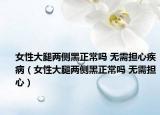 女性大腿两侧黑正常吗 无需担心疾病（女性大腿两侧黑正常吗 无需担心）