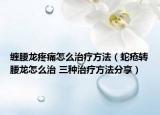 缠腰龙疼痛怎么治疗方法（蛇疮转腰龙怎么治 三种治疗方法分享）