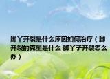 脚丫开裂是什么原因如何治疗（脚开裂的克星是什么 脚丫子开裂怎么办）
